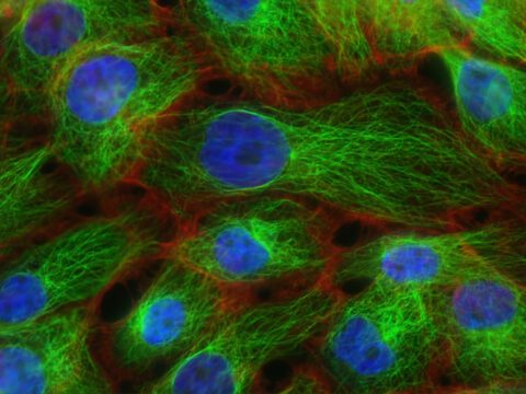 Allgegenwärtige Kunststoffe biologisch abbaubar machen