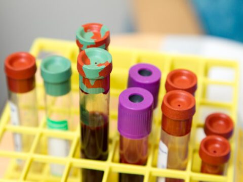 Peptid-Boronsäuren: Neue Perspektiven für die Immunologie