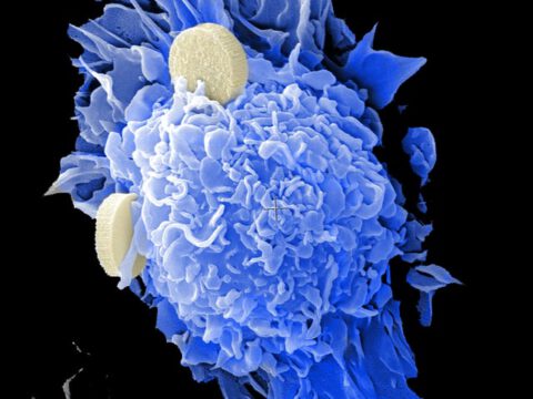 Allgegenwärtige Kunststoffe biologisch abbaubar machen Allgegenwärtige Kunststoffe biologisch abbaubar machen